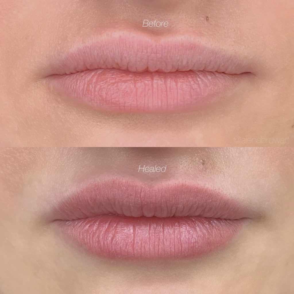 lips-main-4-opt